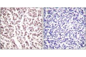Immunohistochemistry analysis of paraffin-embedded human lymph node tissue, using Bloom Syndrome (Ab-99) Antibody. (Bloom Syndrome (AA 65-114) antibody)