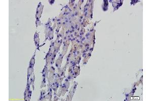 Formalin-fixed and paraffin embedded rat pancreas tissue labeled with Anti-FAF1 Polyclonal Antibody, Unconjugated (ABIN675309) followed by conjugation to the secondary antibody and DAB staining (FAF1 antibody  (AA 551-650))