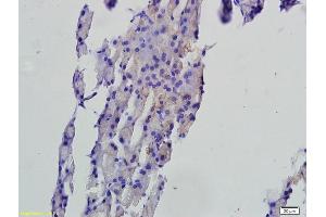 Formalin-fixed and paraffin embedded rat pancreas tissue labeled with Anti-FAF1 Polyclonal Antibody, Unconjugated (ABIN675309) followed by conjugation to the secondary antibody and DAB staining