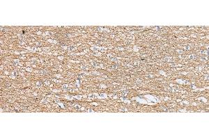 Immunohistochemistry of paraffin-embedded Human brain tissue using IDO2 Polyclonal Antibody at dilution of 1:45(x200) (IDO2 antibody)
