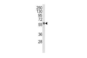 Western blot analysis of ALDH3B1 Antibody (Center) (ABIN652651 and ABIN2842437) in MDA-M cell line lysates (35 μg/lane). (ALDH3B1 antibody  (AA 334-360))