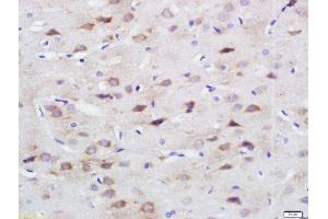 Paraformaldehyde-fixed, paraffin embedded rat brain, Antigen retrieval by boiling in sodium citrate buffer (pH6) for 15min, Block endogenous peroxidase by 3% hydrogen peroxide for 30 minutes, Blocking buffer (normal goat serum) at 37°C for 20min, Antibody incubation with SPARC Polyclonal Antibody, Unconjugated  at 1:200 overnight at 4°C, followed by a conjugated secondary and DAB staining. (SPARC antibody  (AA 101-200))