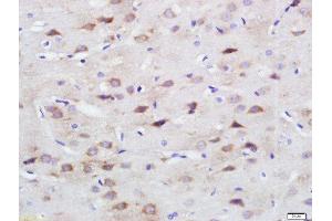 Paraformaldehyde-fixed, paraffin embedded rat brain, Antigen retrieval by boiling in sodium citrate buffer (pH6) for 15min, Block endogenous peroxidase by 3% hydrogen peroxide for 30 minutes, Blocking buffer (normal goat serum) at 37°C for 20min, Antibody incubation with SPARC Polyclonal Antibody, Unconjugated  at 1:200 overnight at 4°C, followed by a conjugated secondary and DAB staining.