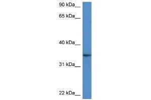 WB Suggested Anti-Dhrs3 Antibody   Titration: 1. (DHRS3 antibody  (Middle Region))