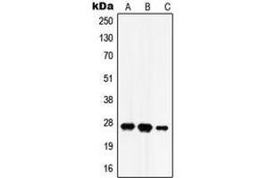 Western blot analysis of HADH2 expression in SKNSH (A), HEK293T (B), rat brain (C) whole cell lysates. (HSD17B10 antibody  (Center))