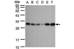 WB Image Sample(30 ug whole cell lysate) A: 293T B: A431 , C: H1299 D: HeLa S3 , E: Hep G2 , F: Raji , 12% SDS PAGE antibody diluted at 1:1000 (AK4 antibody)