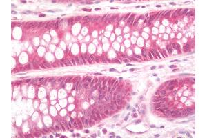 Human Colon: Formalin-Fixed, Paraffin-Embedded (FFPE). (TMED9 antibody  (Biotin))