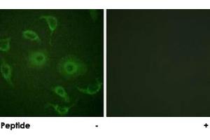 Immunofluorescence analysis of HepG2 cells, using IFNAR1 polyclonal antibody . (IFNAR1 antibody)