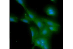 ICC/IF analysis of MYD88 in A549 cells line, stained with DAPI (Blue) for nucleus staining and monoclonal anti-human MYD88 antibody (1:100) with goat anti-mouse IgG-Alexa fluor 488 conjugate (Green). (MYD88 antibody  (AA 1-309))