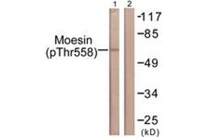 Western blot analysis of extracts from NIH-3T3 cells, using Moesin/Ezrin/Radixin (Phospho-Thr558) Antibody. (Moesin/ezrin/radixin (AA 524-573), (pThr558) antibody)