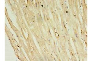 Immunohistochemistry of paraffin-embedded human heart tissue using ABIN7146812 at dilution of 1:100 (Phospholamban antibody  (AA 1-52))