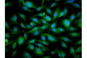Immunofluorescence staining of U251 cells with ABIN7169865 at 1:66, counter-stained with DAPI. (SNRPE antibody  (AA 1-92))