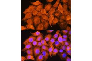Immunofluorescence analysis of HeLa cells using  Rabbit pAb  at dilution of 1:100. (ASS1 antibody  (AA 1-412))