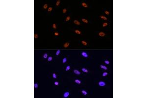 Immunofluorescence analysis of HeLa cells using MITF Rabbit mAb (ABIN7268511) at dilution of 1:100 (40x lens). (MITF antibody)