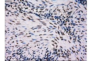 Immunohistochemical staining of paraffin-embedded pancreas tissue using anti-MRI1mouse monoclonal antibody. (MRI1 antibody)