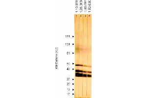 Western Blotting (WB) image for anti-ICP36 DNA Binding Protein (CMV ICP36) antibody (ABIN265543) (ICP36 DNA Binding Protein (CMV ICP36) antibody)