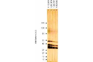 Western Blotting (WB) image for anti-ICP36 DNA Binding Protein (CMV ICP36) antibody (ABIN265543) (ICP36 DNA Binding Protein (CMV ICP36) antibody)