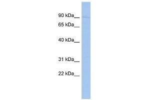 WB Suggested Anti-SAntibody Titration:  0. (SP110 antibody  (Middle Region))