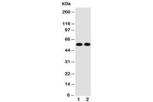 Western blot testing of Alpha Amylase 1 antibody and Lane 1:  rat liver (Alpha-amylase 1 antibody  (N-Term))