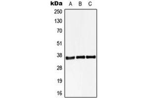 Western blot analysis of STARD10 expression in HEK293T (A), Raw264. (STARD10 antibody  (Center))