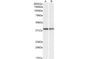 ABIN1782187 (0. (CAPG antibody  (AA 205-217))