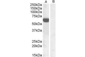 HEK293 overexpressing human IRF5 and probed with ABIN184812 at 1ug/ml (mock transfection in lane B). (IRF5 antibody  (C-Term))