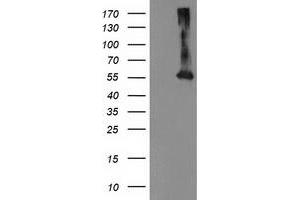 Western Blotting (WB) image for anti-Makorin Ring Finger Protein 1 (MKRN1) antibody (ABIN1499487)