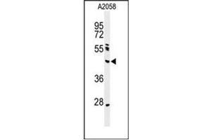 Western blot analysis of NEIL1 Antibody (Center) in A2058 cell line lysates (35ug/lane).