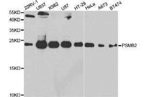 Western blot analysis of extracts of various cell lines, using PSMB2 antibody (ABIN5973193) at 1/1000 dilution. (PSMB2 antibody)