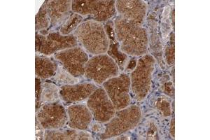 Immunohistochemical staining of human kidney with SERPINA7 polyclonal antibody  shows cytoplasmic and extracellular positivity in cells of tubules. (SERPINA7 antibody)