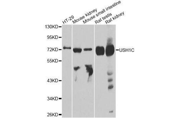 USH1C antibody  (AA 1-100)