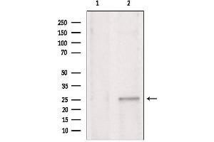 Western blot analysis of extracts from rat brain, using CHCHD6 antibody. (CHCHD6 antibody  (Internal Region))