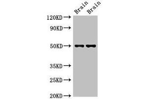 Western Blot Positive WB detected in: Mouse brain tissue, Rat brain tissue All lanes: Gfap antibody at 2. (GFAP antibody  (AA 1-430))