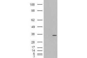 Image no. 6 for anti-Pancreatic and Duodenal Homeobox 1 (PDX1) antibody (ABIN1500144) (PDX1 antibody)