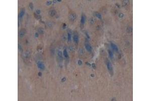 IHC-P analysis of Kidney tissue, with DAB staining. (IDS antibody  (AA 107-363))