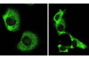Image no. 2 for anti-Autophagy/beclin-1 Regulator 1 (AMBRA1) (N-Term) antibody (ABIN347117) (AMBRA1 antibody  (N-Term))