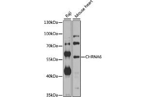 Western blot analysis of extracts of various cell lines, using CHRN antibody  at 1:1000 dilution. (CHRNA6 antibody  (AA 350-440))