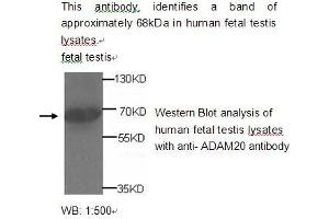 Image no. 1 for anti-ADAM Metallopeptidase Domain 20 (ADAM20) antibody (ABIN790772)