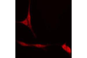 ABIN6274553 staining Hela cells by IF/ICC. (ATF5 antibody  (N-Term))