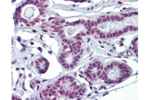 SOX4 antibody was used for immunohistochemistry at a concentration of 4-8 ug/ml. (SOX4 antibody  (N-Term))
