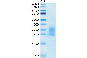 Mouse NKG2D/CD314 on Tris-Bis PAGE under reduced condition. (KLRK1 Protein (AA 90-232) (His tag))