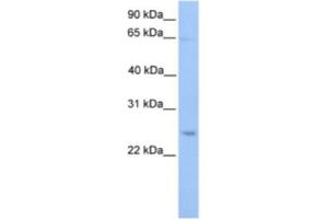 Western Blotting (WB) image for anti-Autophagy Related 10 (ATG10) antibody (ABIN2463627) (ATG10 antibody)