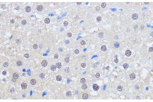 Immunohistochemistry of paraffin-embedded Rat liver using RBM39 Polyclonal Antibody at dilution of 1:100 (40x lens). (RBM39 antibody)