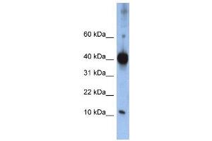 WB Suggested Anti-LSM4  Antibody Titration: 0. (LSM4 antibody  (Middle Region))