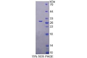 SDS-PAGE analysis of Mouse FBLN7 Protein.