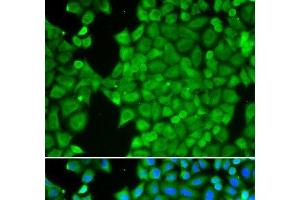 Immunofluorescence analysis of HeLa cells using CA3 Polyclonal Antibody (CA3 antibody)