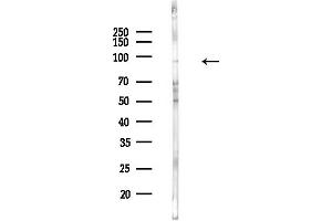 Western blot analysis of lysates from COLO205 cells(UV,30 min treatment), using Phospho-IKK beta (Tyr188) Antibody at 1/1000 dilution.