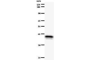 Western Blotting (WB) image for anti-Nuclear Factor of Activated T-Cells, Cytoplasmic, Calcineurin-Dependent 3 (NFATC3) antibody (ABIN932193) (NFATC3 antibody)
