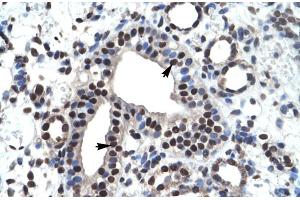 Rabbit Anti-ZNF499 Antibody Catalog Number: ARP30017 Paraffin Embedded Tissue: Human Kidney Cellular Data: Epithelial cells of collecting tubule Antibody Concentration: 4. (ZBTB45 antibody  (Middle Region))