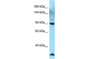 Western Blotting (WB) image for anti-EZR-ROS1 (C-Term) antibody (ABIN2789629) (EZR-ROS1 (C-Term) antibody)